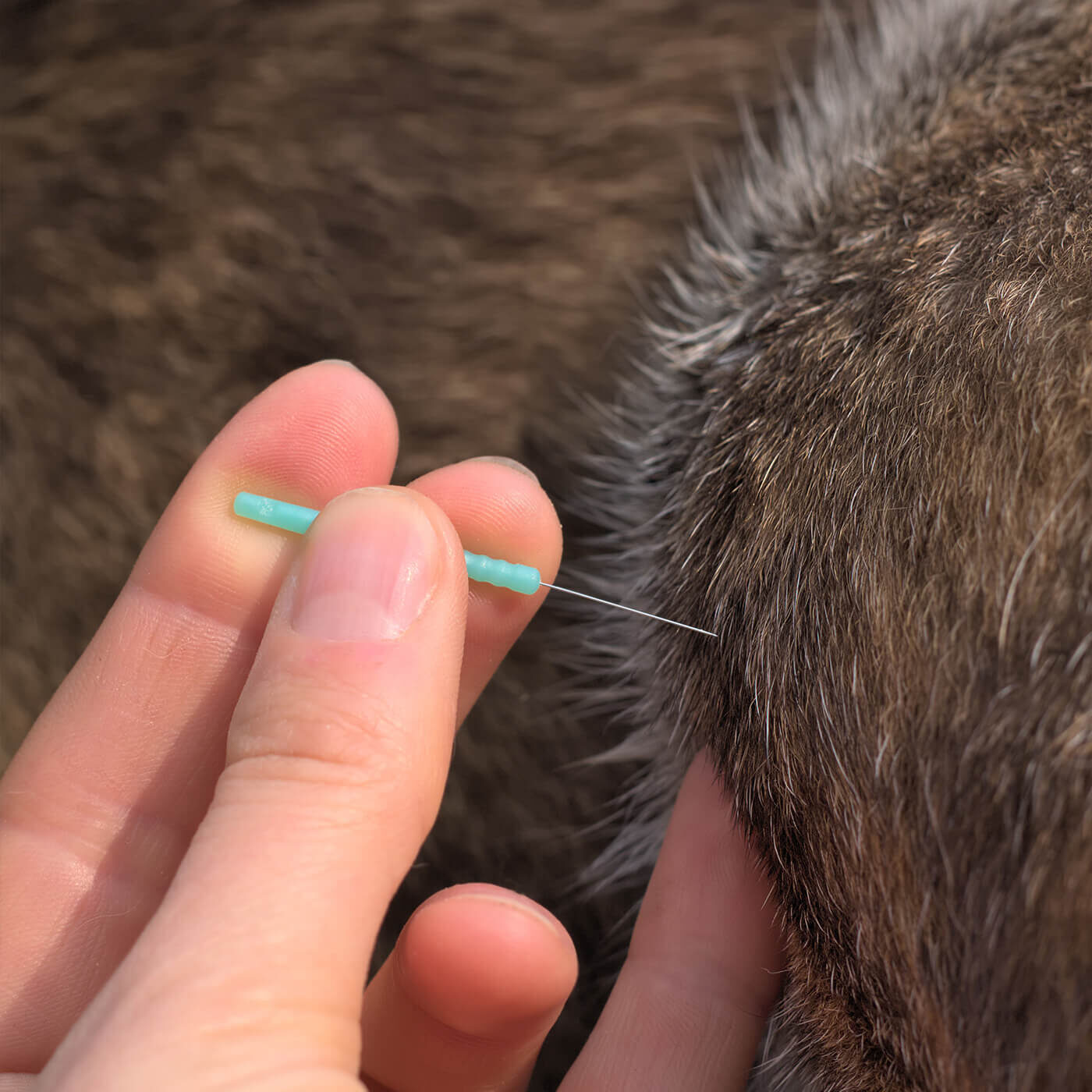 closeup of acupuncture needle