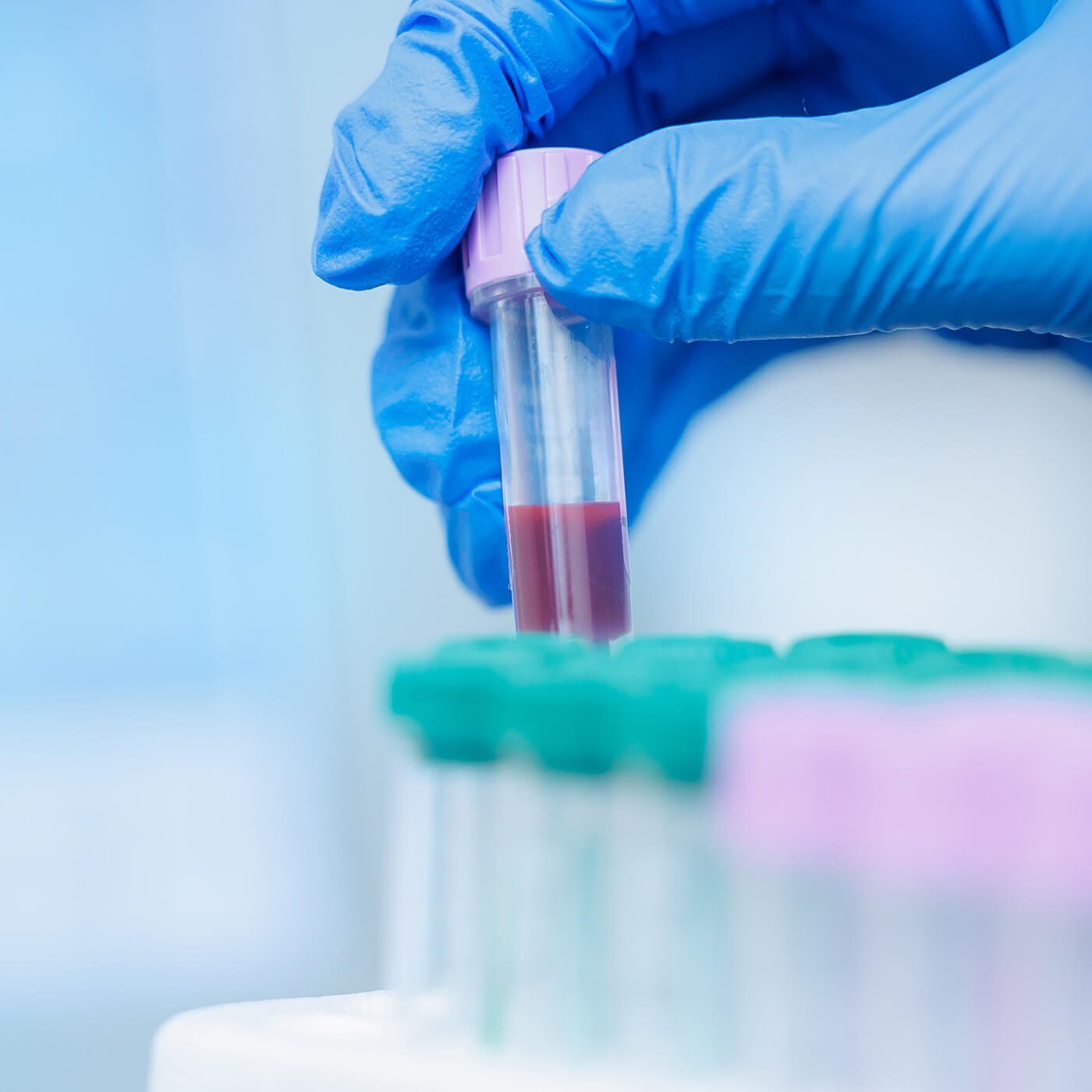 closeup of vet holding vial of blood